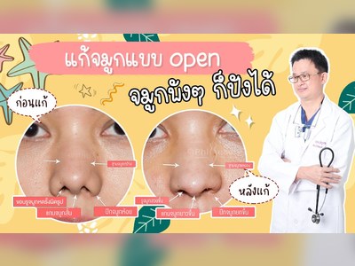 Phibeautyclinic surgery phuket