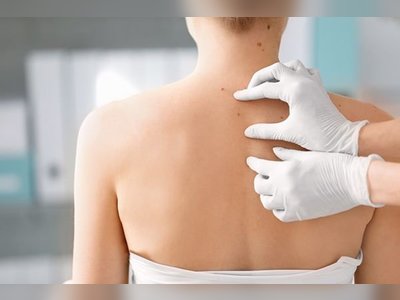 Asoke Skin Hospital