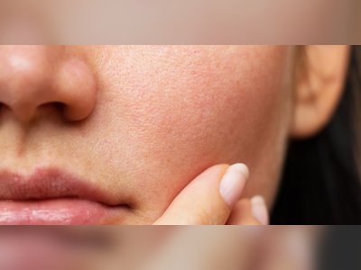 Skin Element Clinic