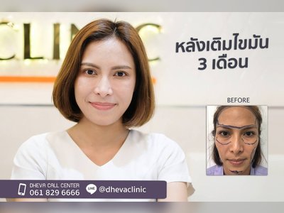 ดีวา คลินิก