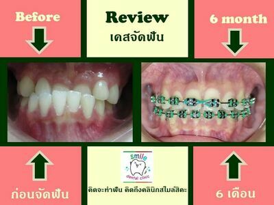 Smile Dental Clinic, Suphanburi