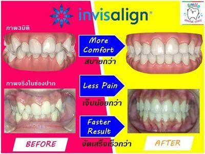 Smile Dental Clinic, Suphanburi