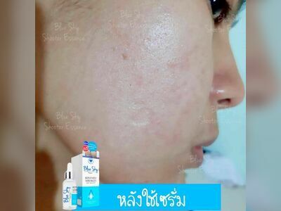 SK Skincare Suphanburi