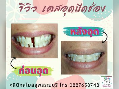 Smile Dental Clinic, Suphanburi