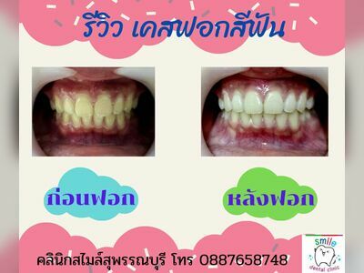Smile Dental Clinic, Suphanburi