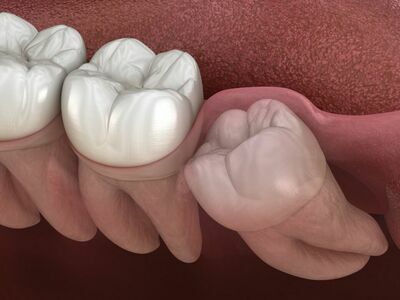 Gum and Tooth Clinic – Expert Dental Services in Suphanburi Province