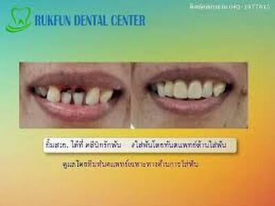 Rakfun Dental Clinic - Orthodontics & Dentistry, Specialist Dentists in Suphanburi