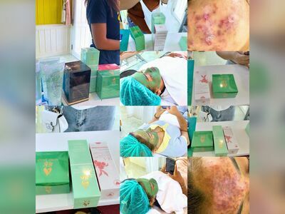 SK Skincare Suphanburi