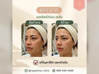 Napatchar Clinic Phuket