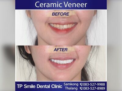 TP Smile Samkong