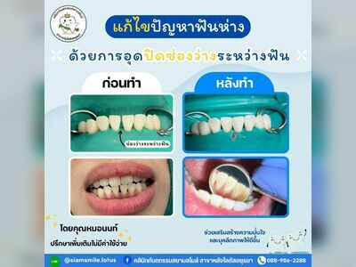 Siam Smile Dental Clinic, Ayutthaya Branch