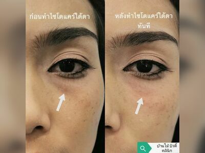 Banmai beauty clinic Phangnga