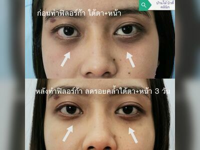 Banmai beauty clinic Phangnga