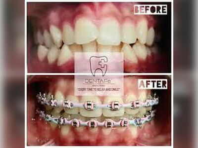 DENTAFe Dental Clinic