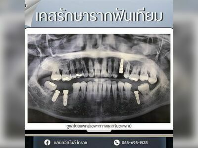 V-Smile Dental Clinic - Korat
