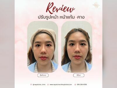Napatchar Clinic Phuket