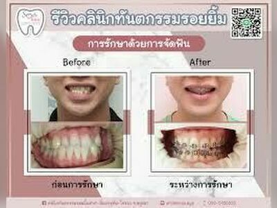 Smile Dental Clinic, Uthai-Rojana Intersection Branch, Ayutthaya