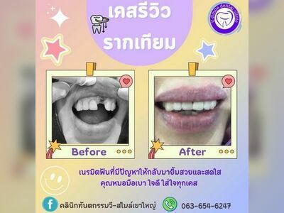 V-Smile Dental Clinic - Korat