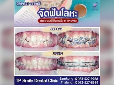 TP Smile Samkong