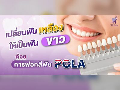 TP Smile Samkong