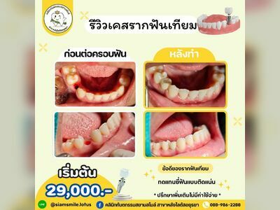 Siam Smile Dental Clinic, Ayutthaya Branch