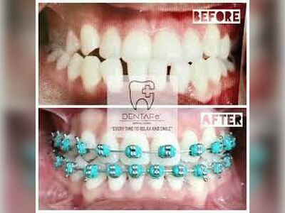 DENTAFe Dental Clinic