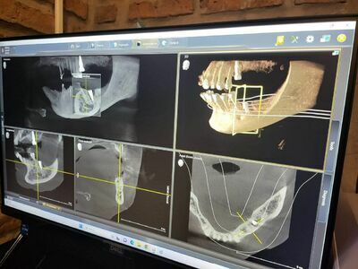 Smile Room Dental Clinic