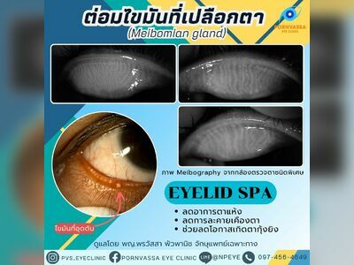 Pornvassa Eye Clinic