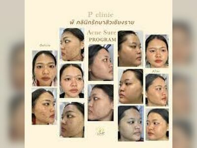 P Clinic Acne Treatment Chiang Rai