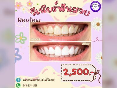V-Smile Dental Clinic - Korat