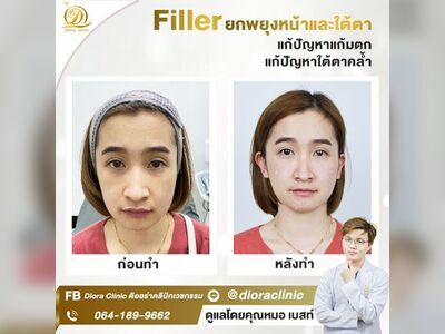 Diora Clinic Chanthaburi