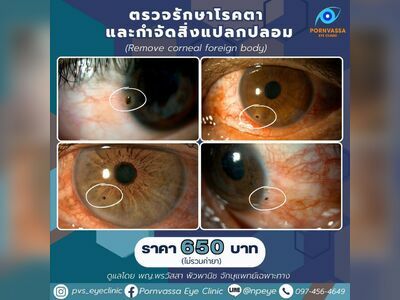 Pornvassa Eye Clinic