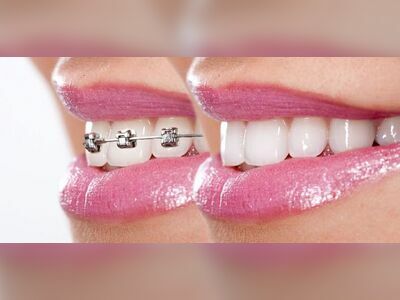 Dental Factory Clinic by ฟันดี Family Dental Clinic - Central Rayong Branch