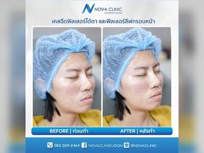 Nova Clinic Udon Thani Nova Clinic