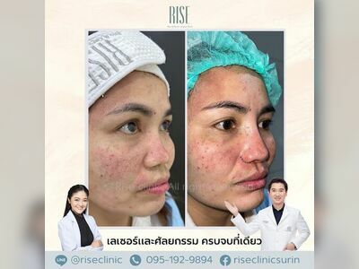 RISE Clinic