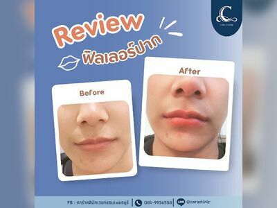 Caraclinic (คาร่าคลินิกความงามเพชรบุรี)