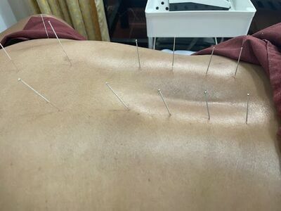 Tantawan Traditional Chinese Medicine Clinic