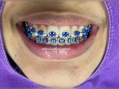 Smile Design Dental Clinic, Phetchaburi