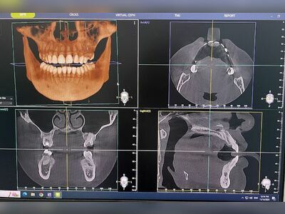Easy Smile Dental Clinic