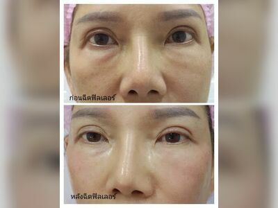 Saeng Rawi Clinic (Dr. Liw)