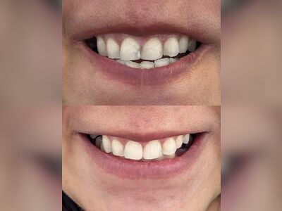 Tooth Space Dental Clinic, Phetchaburi