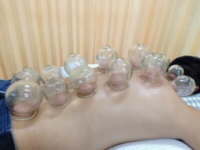 Apichaya Clinic - Traditional Chinese Medicine / Acupuncture & Chinese Herbs