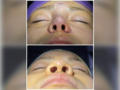 UVC by DR.Mynt