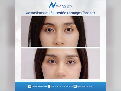 Nova Clinic Udon Thani Nova Clinic