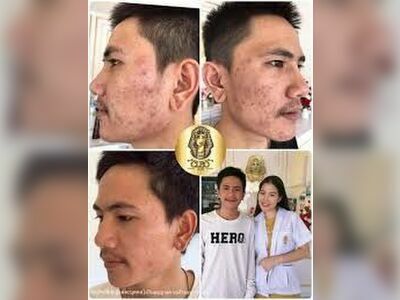 Cleo Skin Lampang