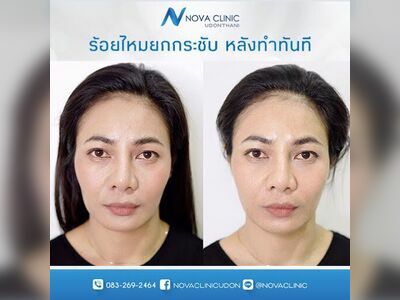 Nova Clinic Udon Thani Nova Clinic