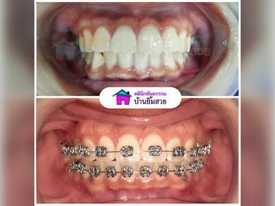 Baan Yim Suay Dental Clinic, Phetchaburi