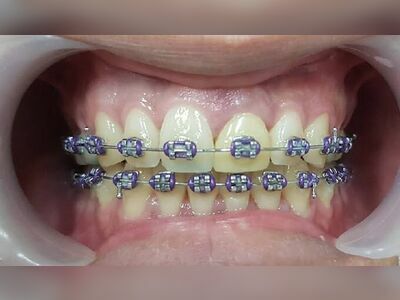 Tontann Dental Clinic