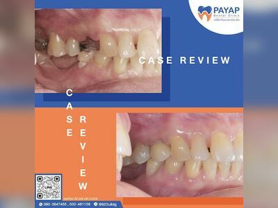 Phayap Dental Clinic, Phetchaburi