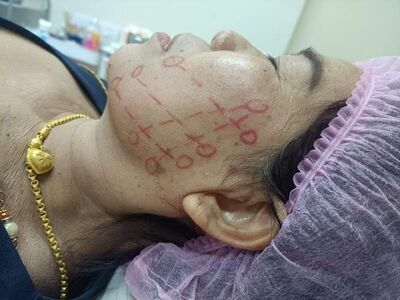 Saeng Rawi Clinic (Dr. Liw)